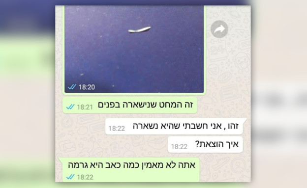 הרופא שכח מחט בסנטר וחטפה זיהום