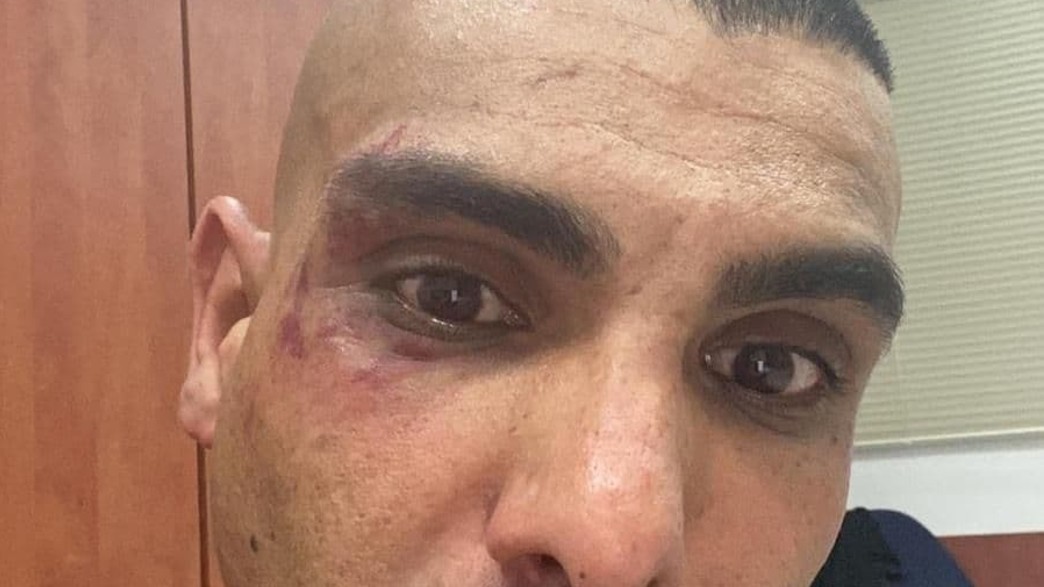 נדים שתיוי, טוען שהותקף בחוף הים באולגה