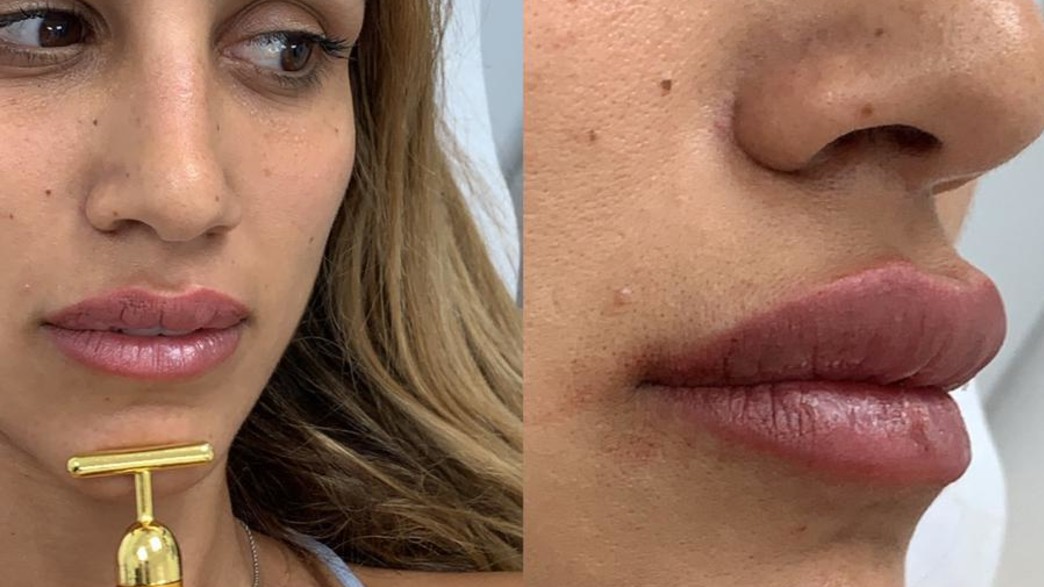 פאני בוזגלו עשתה שפתיים פאני בוזגלו עשתה שפתיים