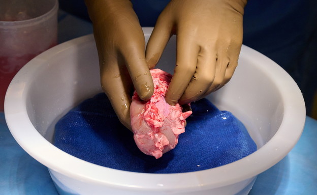 השתלת כליה של חזיר בגוף אנושי (צילום: reuters)