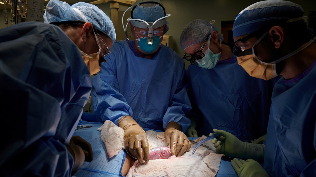 השתלת כליה של חזיר בגוף אנושי השתלת כליה של חזיר בגוף אנושי