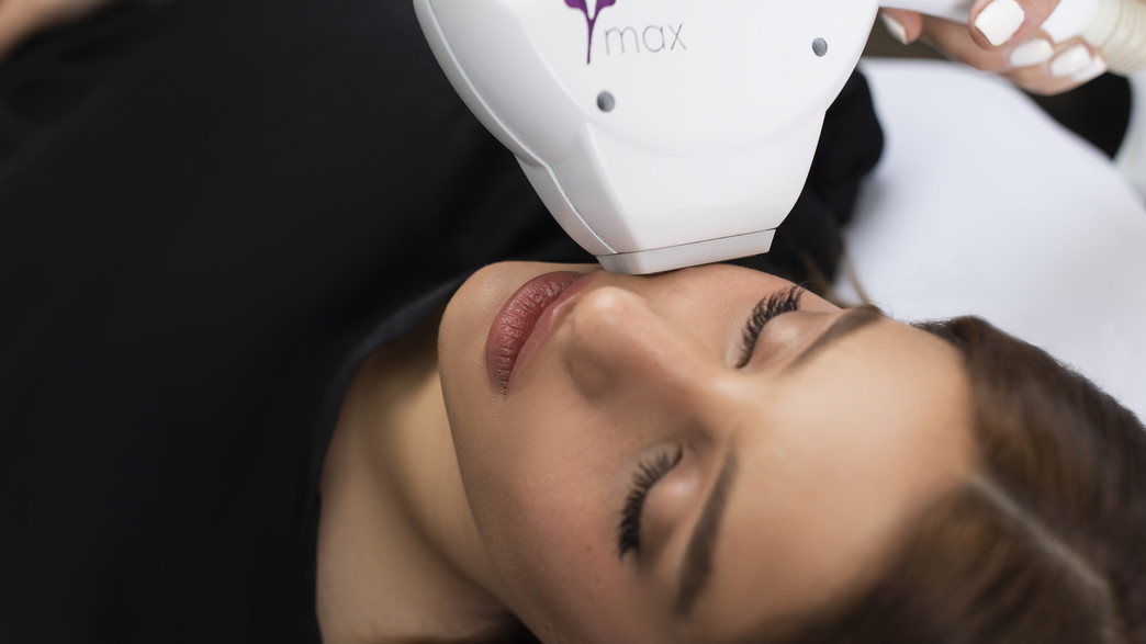 הסרת שיער בפנים, יפה מקסימוב הסרת שיער בפנים, יפה מקסימוב