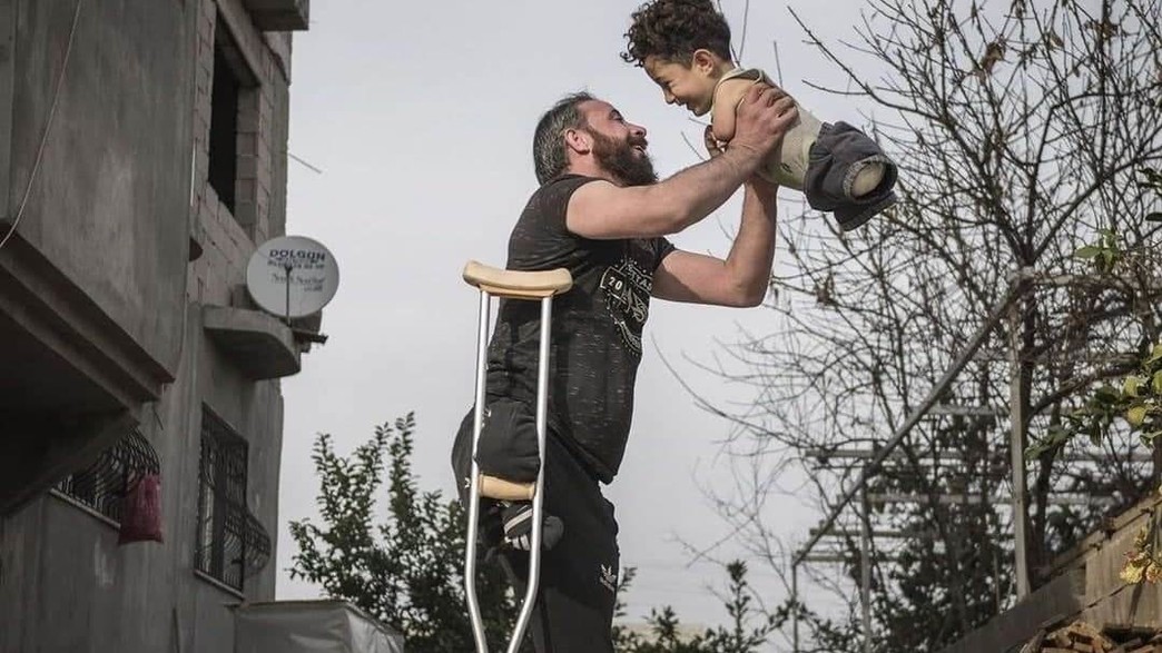 פליט סורי שמחזיק את בנו שנולד ללא גפיים פליט סורי שמחזיק את בנו שנולד ללא גפיים