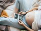 אישה בהיריון מסתכלת על בדיקות אולטרהסאונד (אילוסטרציה: Ilona Titova, shutterstock)