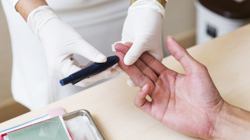 כולסטרול כולסטרול