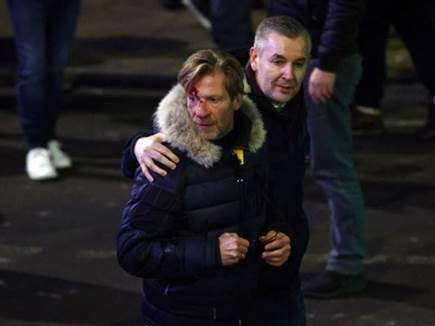 תמונות מזעזעות מאנגליה (Getty Images)