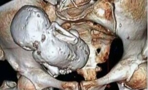 תינוק מאבן (צילום: interestingasfuck, Reddit)