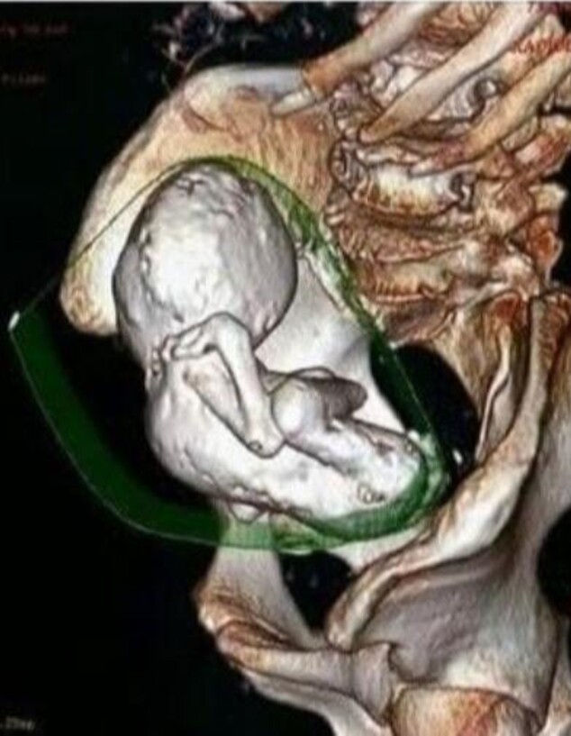 תינוק מאבן (צילום: interestingasfuck, Reddit)