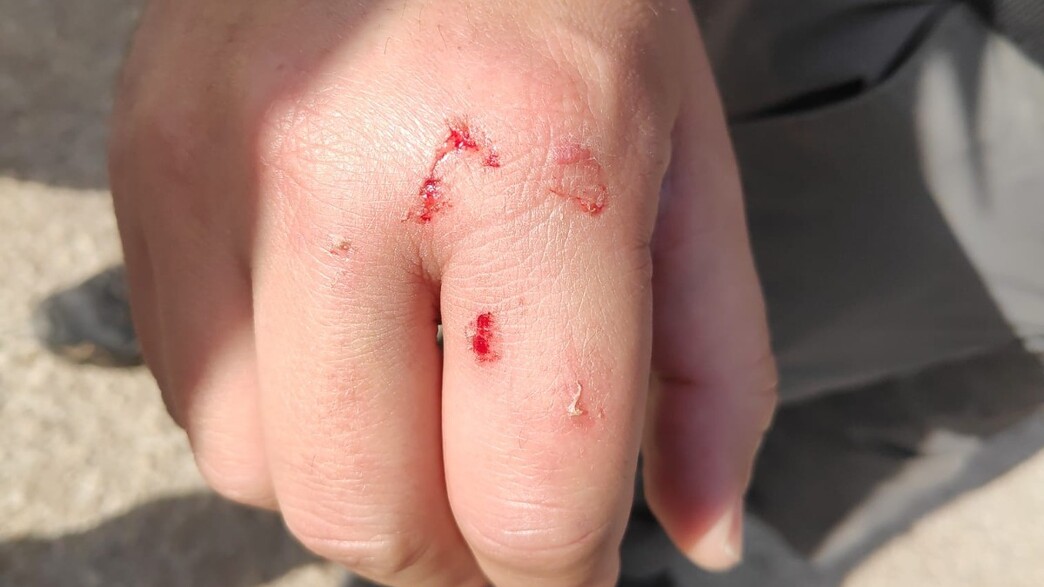 עימותים  בין מתנחלים וכוחות מג"ב ליד יצהר