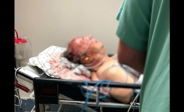 יגאל שילון בבית החולים איכלוב לאחר הנפילה (צילום: מתוך 