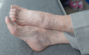 כף רגל, אישה זקנה, כפות רגליים (צילום: Capturedpics, shutterstock)