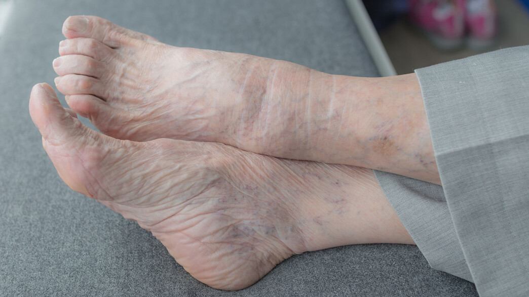 כף רגל, אישה זקנה, כפות רגליים כף רגל, אישה זקנה, כפות רגליים