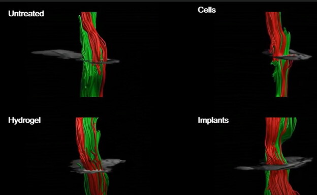 חוקרים  הצליחו  לייצר חוט שדרה אנושי לטיפול במשותקים (צילום: מרכז סגול לביוטכנולוגיה רגנרטיבית)