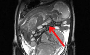 איראן (צילום: IJ Case Reports and Images)