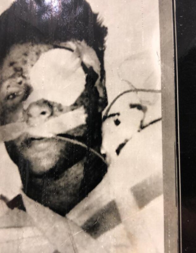 יאיר דורי בבית החולים בקהיר, ימים אחרי נפילתו בשבי (צילום: תקשורת מצרית)