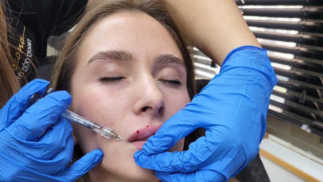 נטליה בוזגלו עושה שפתיים