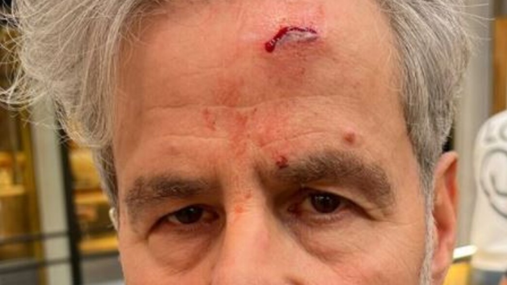 אייל שני ופגיעת מצלמת הרחף