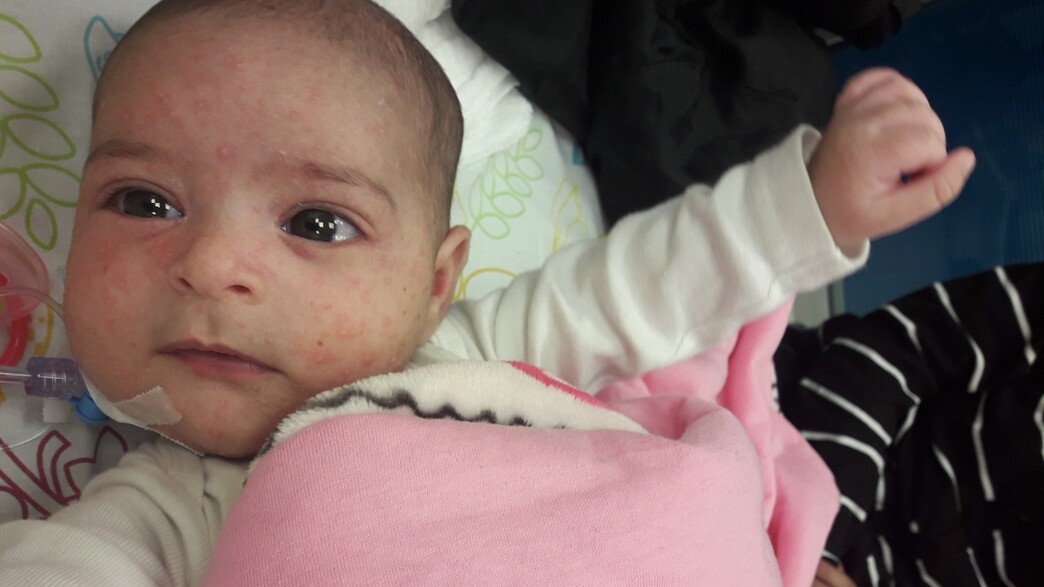 נעמה נפטרה בגיל חצי שנה