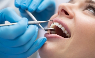 רופא שיניים, טיפול שיניים (צילום: bezikus, shutterstock)
