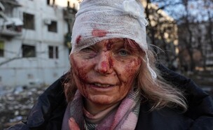 אזרחים אוקראינים שנפגעו מתקיפות רוסיה (צילום: getty images)