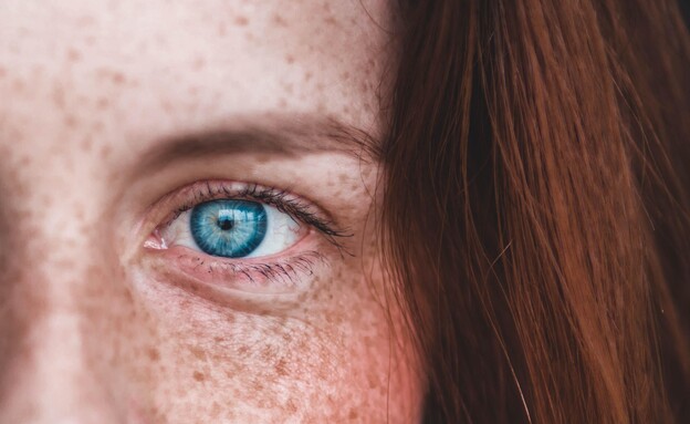 Freckles: Are They Dangerous?