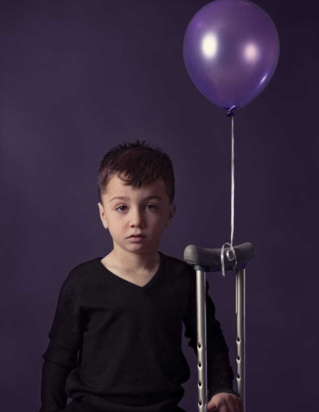פרויקט צילומים עם ילדים חולי אפילפסיה (צילום: סווטה בוטקו)