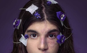 פרויקט צילומים עם ילדים חולי אפילפסיה (צילום: SVETA BUTKO )