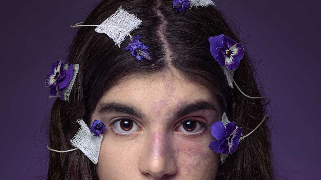 פרויקט צילומים עם ילדים חולי אפילפסיה (צילום: SVETA BUTKO )