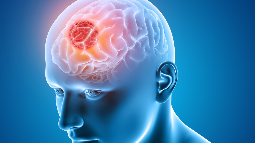 הדמיית מוח תלת ממד | אילוסטרציה הדמיית מוח תלת ממד | אילוסטרציה