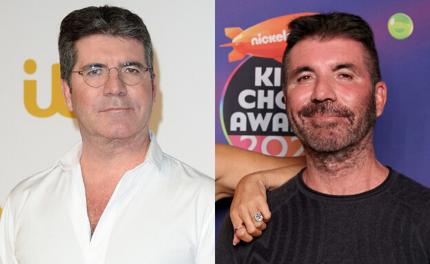“I went too far”: Simon Cowell parted ways with Botox