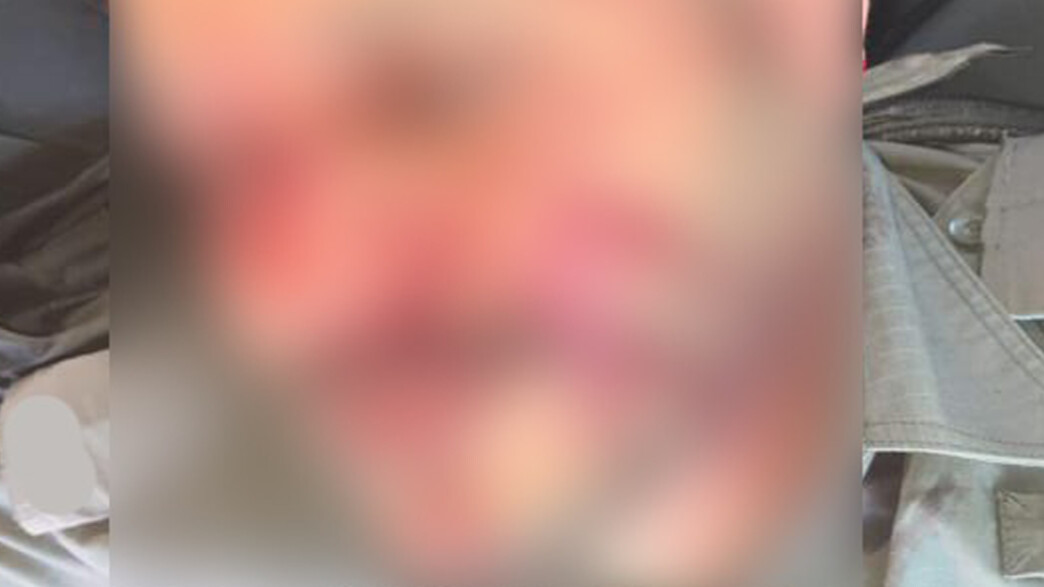 שוטר מג"ב, נפצע, מחבל, תובע אותו שוטר מג"ב, נפצע, מחבל, תובע אותו