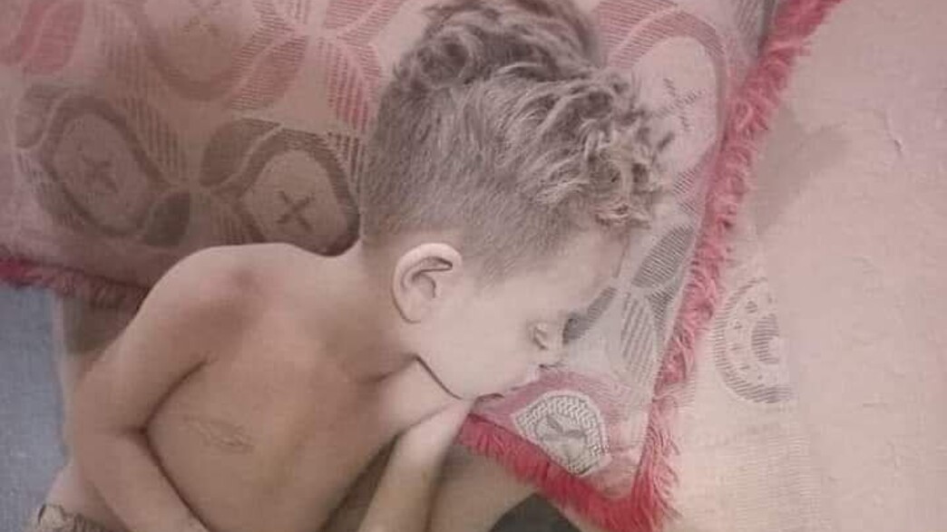 ילדי הפליטים העיראקים לאחר שנחשפו לסופת האבק