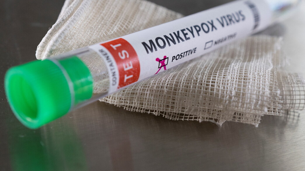 בדיקה של אבעבועות הקוף, אילוסטרציה