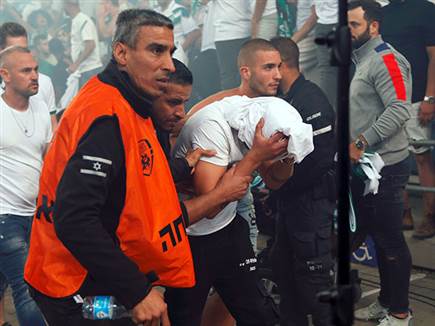 גם תמונות פחות נחמדות היו בטדי (אלן שיבר)