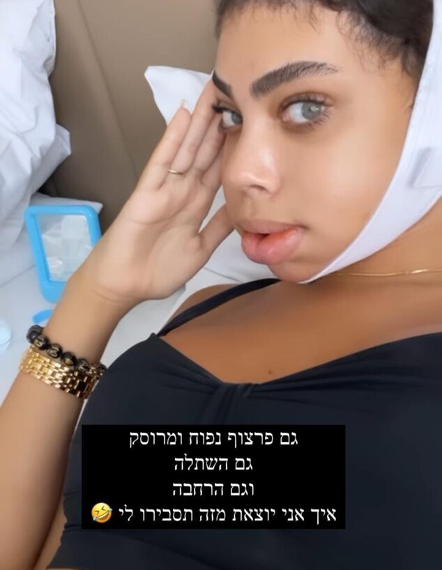 רומי אברג'יל אחרי הניתוח (צילום: instagram)