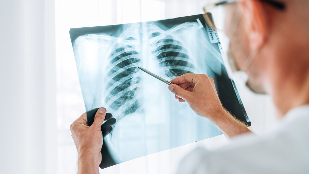 אילוסטרציה