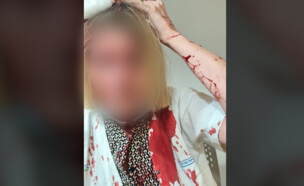 הרופאה שהותקפה בקופת חולים כללית בבאר יעקב