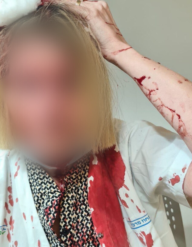 הרופאה שהותקפה בקופת חולים כללית בבאר יעקב