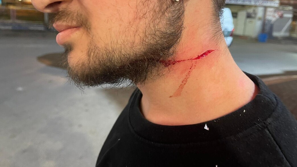 הצעיר שנפצע במהלך השוד בחנות הנוחות