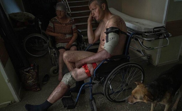 אוקראיני פצוע, אוקראינה (צילום: AP)