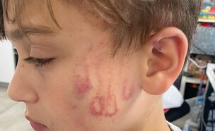 רוי ורטהימר, בן ה-10, הותקף בגן שעשועים