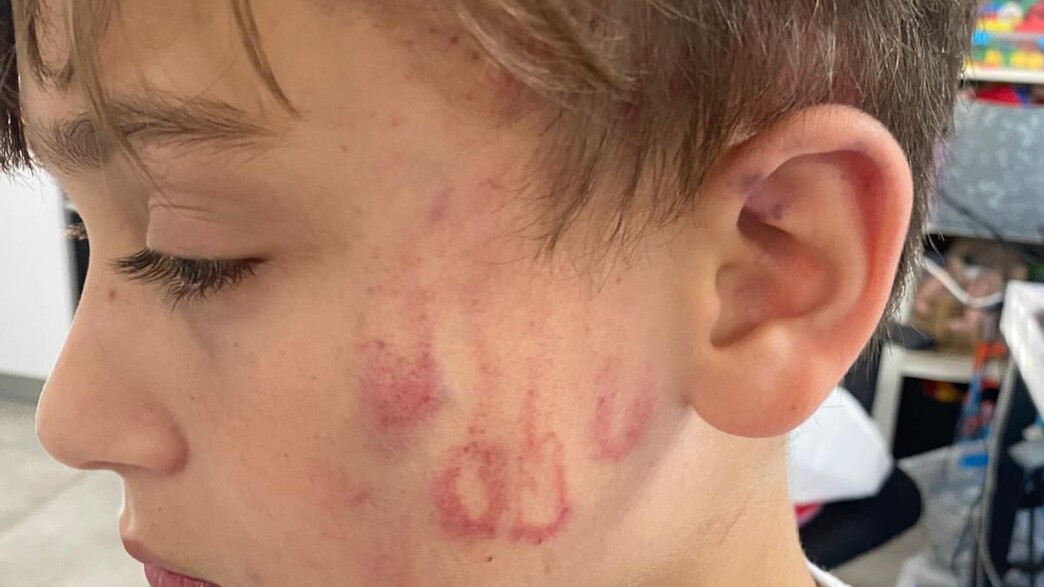 רוי ורטהימר, בן ה-10, הותקף בגן שעשועים רוי ורטהימר, בן ה-10, הותקף בגן שעשועים