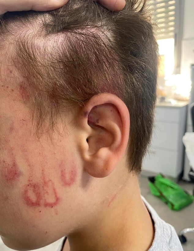 רוי ורטהימר, בן ה-10, הותקף בגן שעשועים