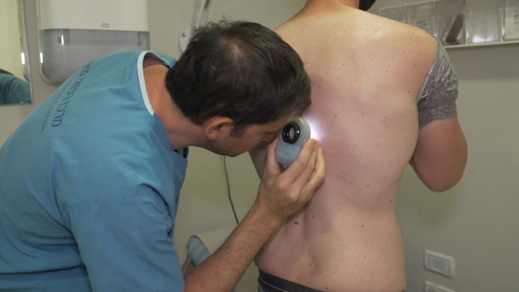 זיהוי נקודת חן מסרטנת