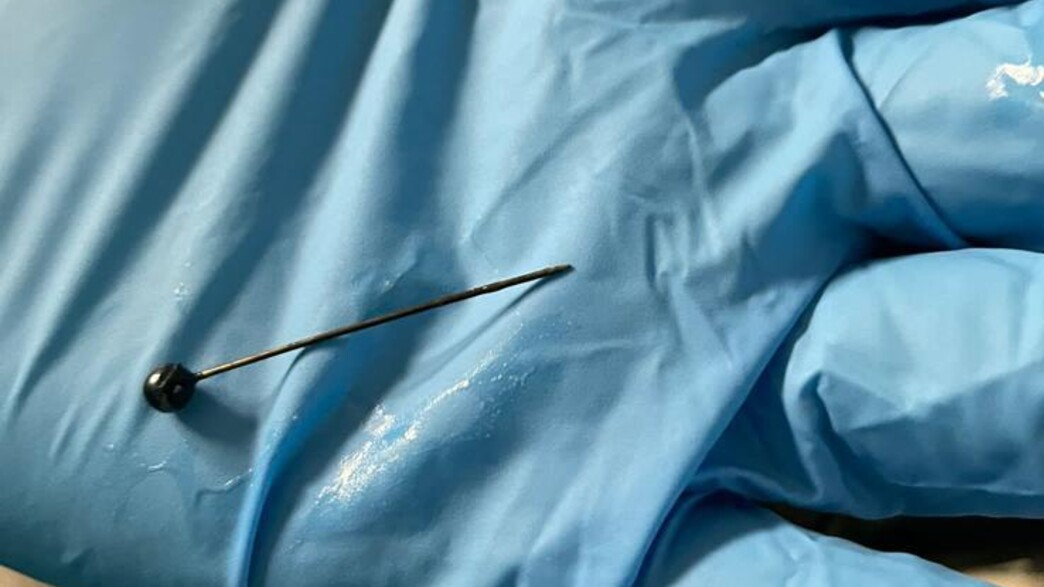 סיכת החיג'אב ננעצה בבטנה של נערה בת 15 סיכת החיג'אב ננעצה בבטנה של נערה בת 15