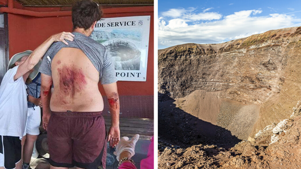 תייר אמריקני נפל להר געש באיטליה