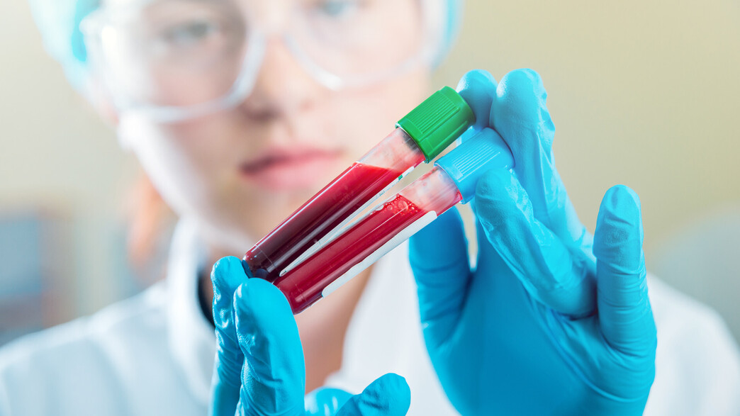 רופאה מחזיקה מבחנות עם דם רופאה מחזיקה מבחנות עם דם