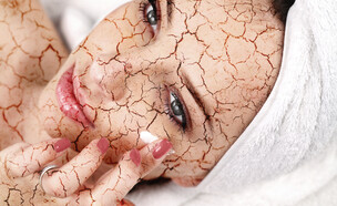 עור יבש (צילום: Shutterstock)