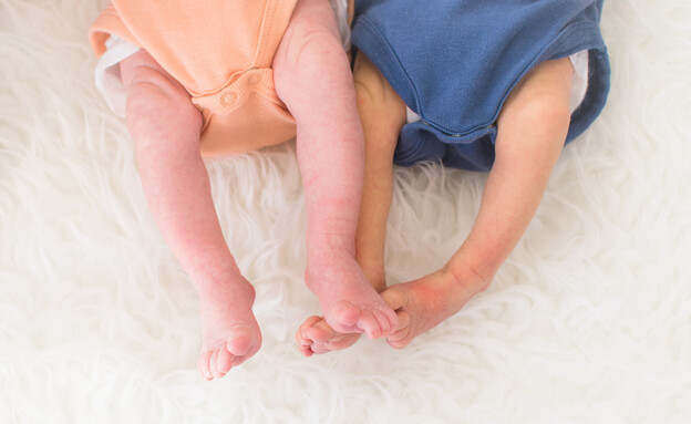 תינוקות עם צהבת (צילום: shutterstock)