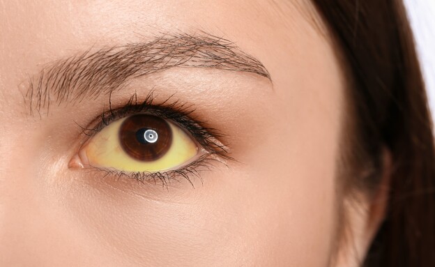 עיניים צהובות  (צילום: shutterstock)